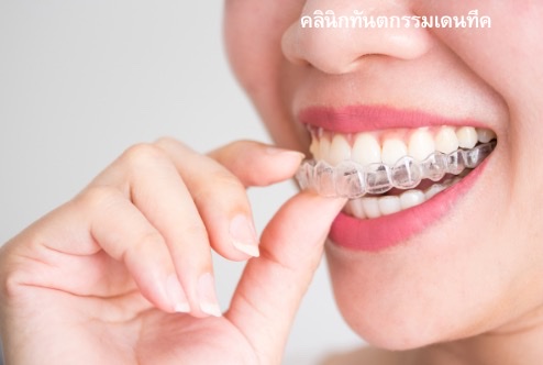orthodontic treatment คลินิกทันตกรรมเดนทีค