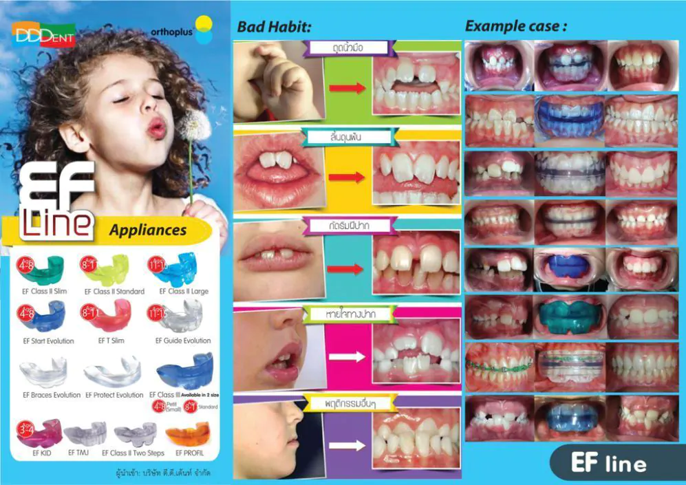 orthodontics treatment คลินิกทันตกรรมเดนทีค